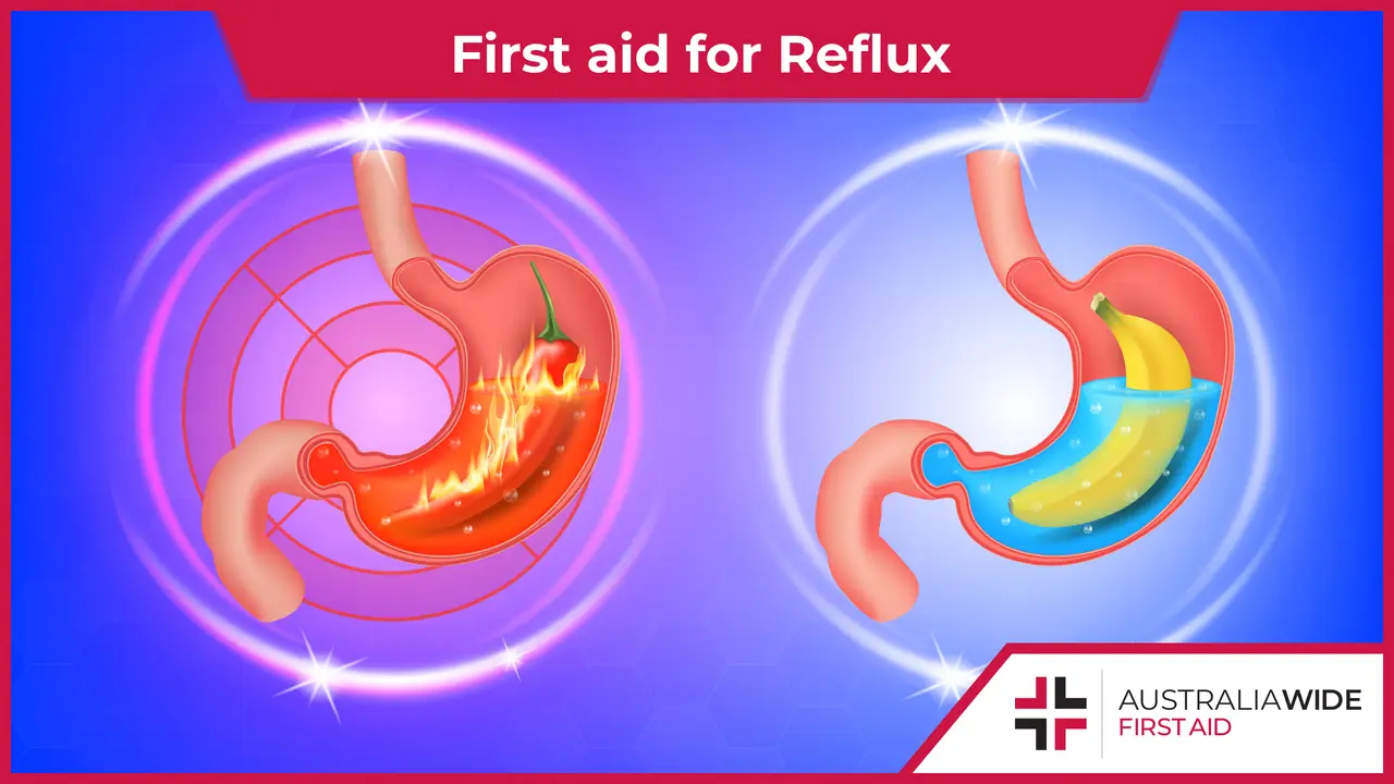 first-aid-for-reflux-heartburn